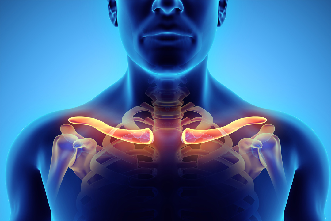 Thoracic Outlet Syndrome Chest Surgery Associates